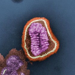 Influenza_virus_particle_color.jpg